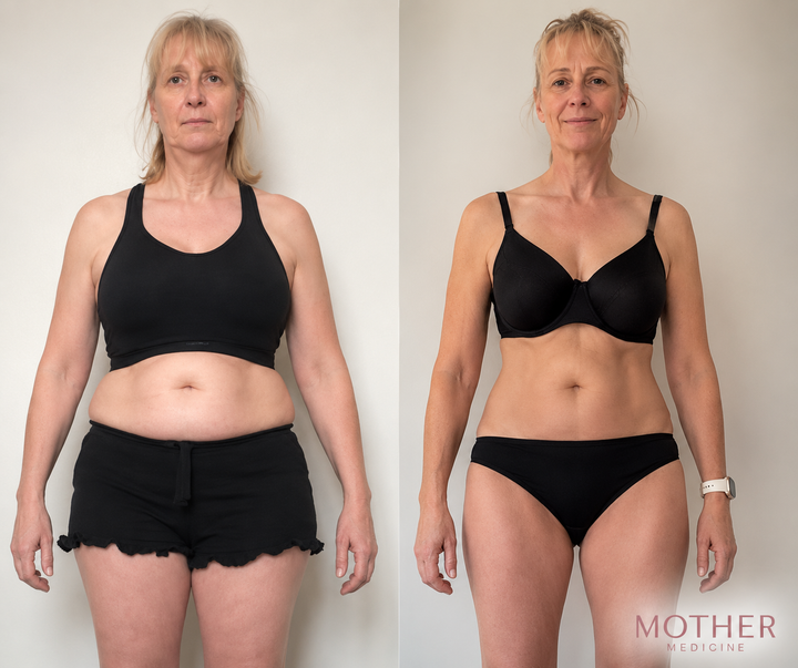 Before and after result