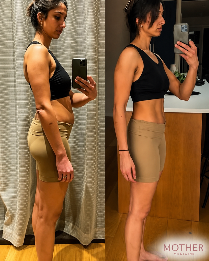 Before and after result